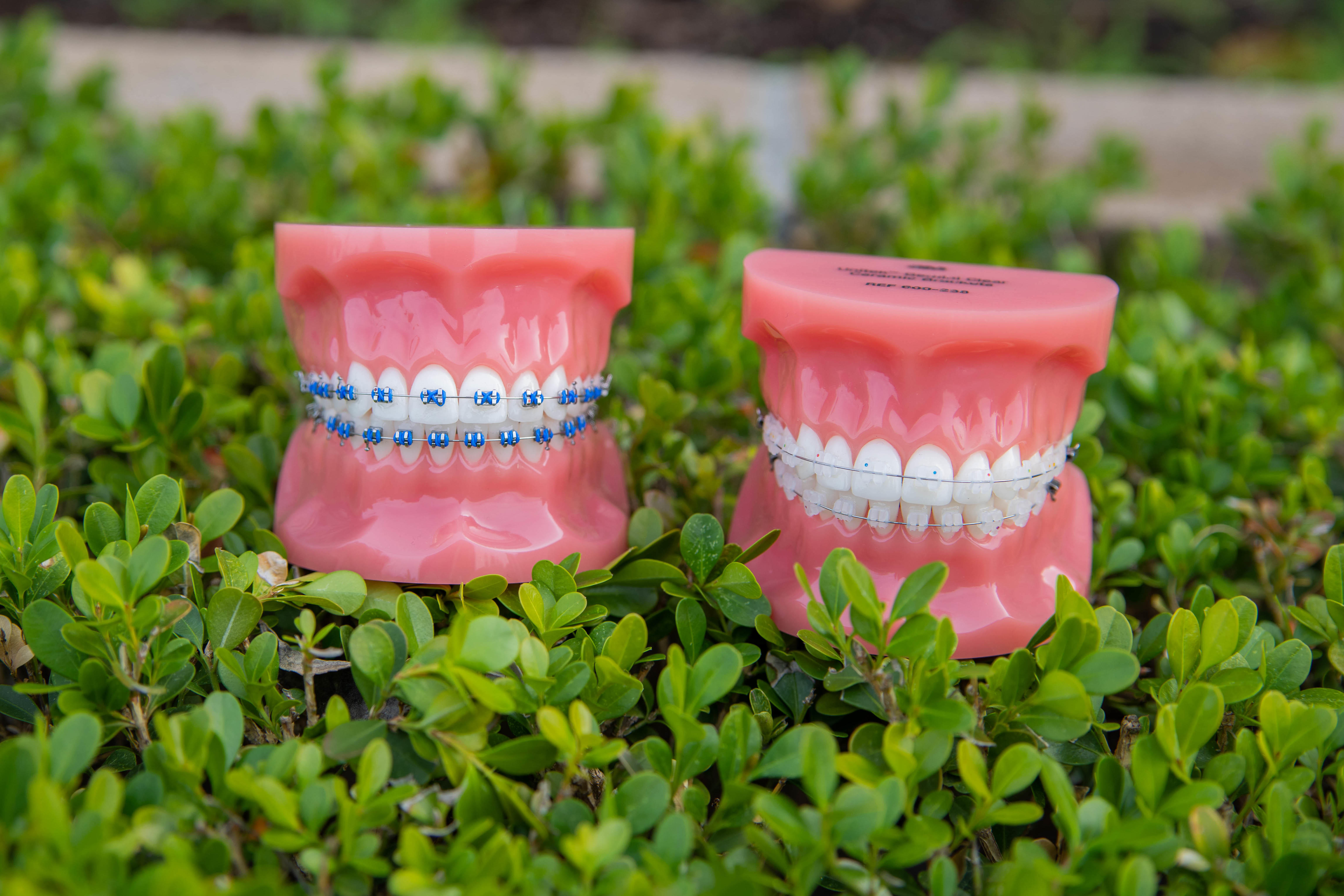 Don't wait any longer to straighten your smile! Orthodontics of Torrance Torrance (424)201-0712