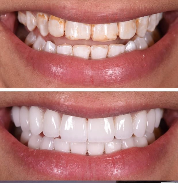 Images Northeast Lincoln Family Dentistry