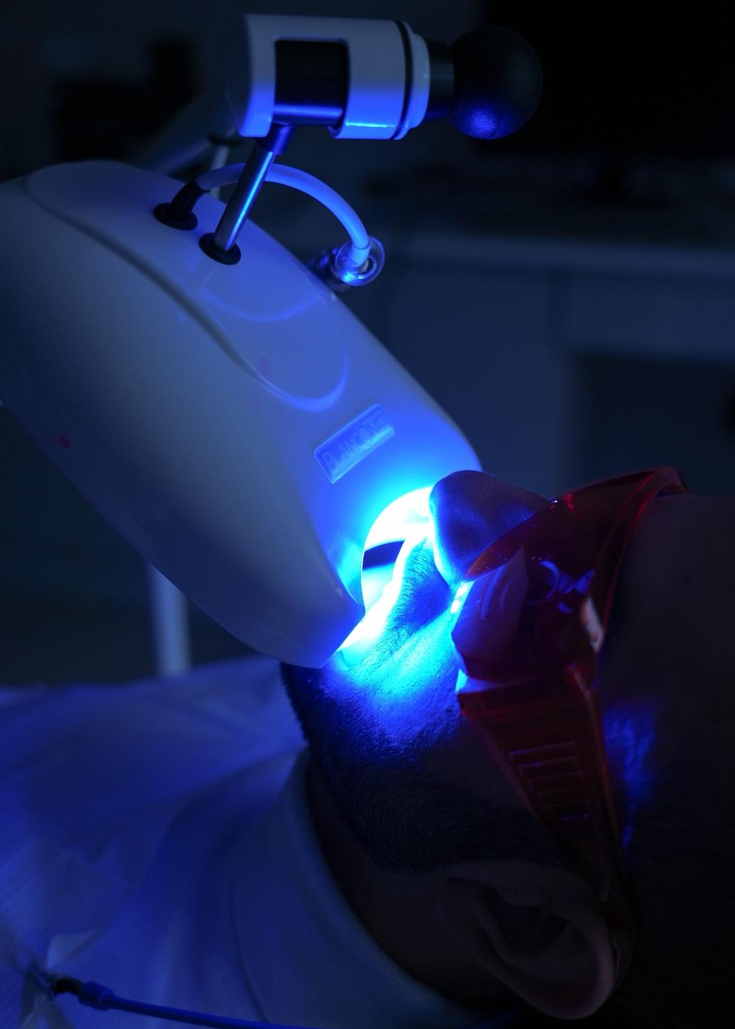 Professional teeth whitening treatment in progress using advanced blue LED whitening light at The Harrogate Clinic, a premier cosmetic dentist in Harrogate, North Yorkshire.