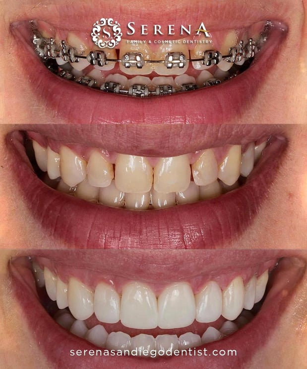 Images Serena San Diego Dentist