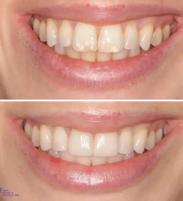 Images Mary Elizabeth Viechnicki, DMD