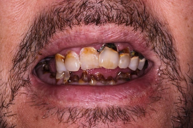 Images SmileCare Dental