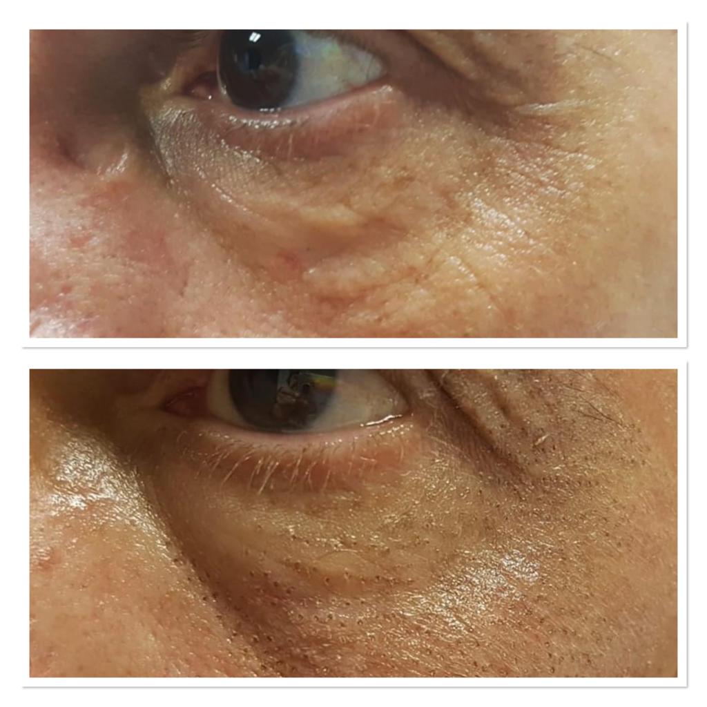 Images Microblading Melany