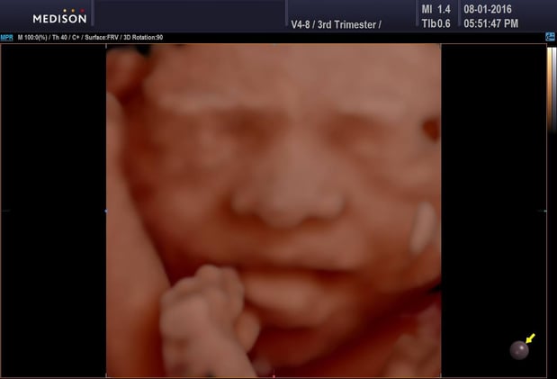 Images Heavenly 3D 4D Ultrasounds-Upland