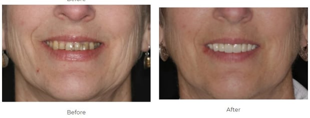 Images Aspen Ridge Dental