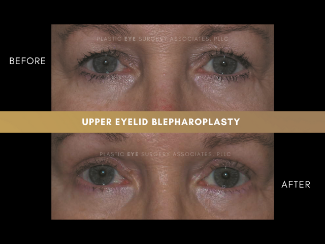 Images Plastic Eye Surgery Associates, PLLC