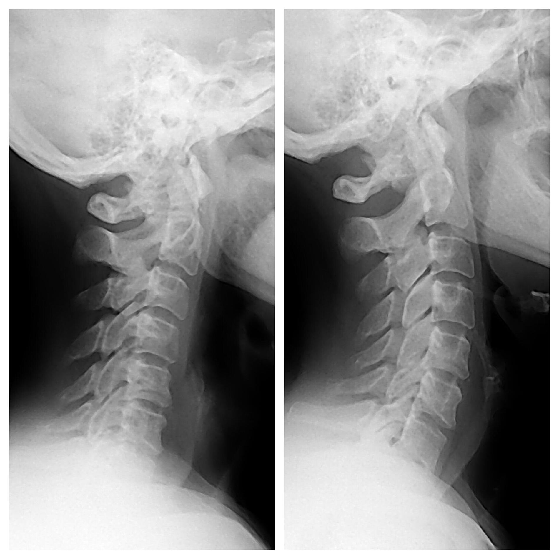 Images Fiorini Chiropractic Center, P.A.