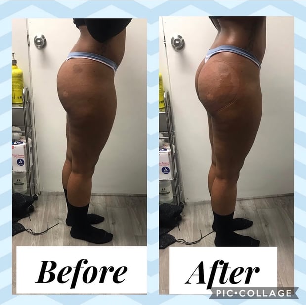 Images Queen Divas Body Sculpting
