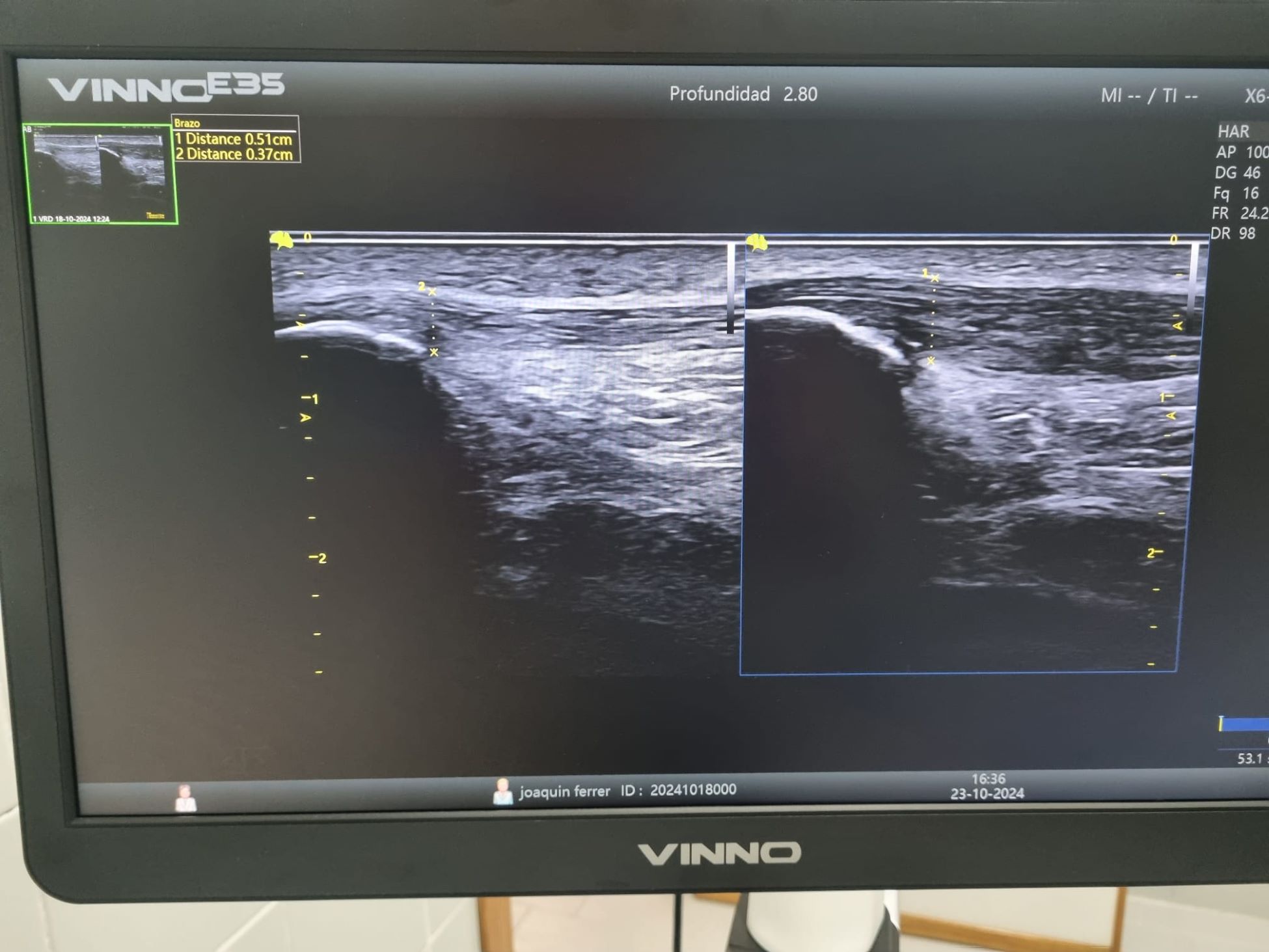 Images FISIOVCLARI Clínica de Fisioterapia
