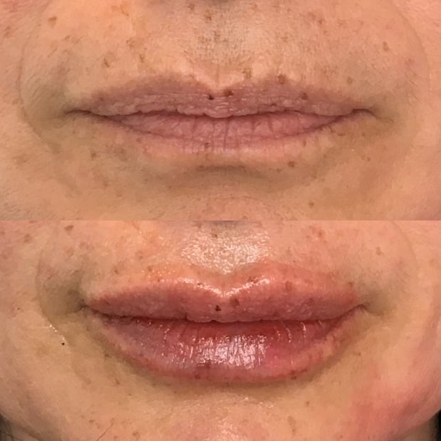 Images BCRN Aesthetics MedSpa