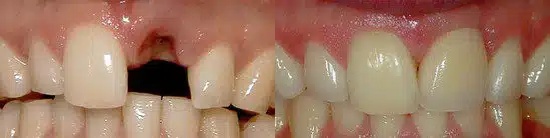 Dental Care of Jackson Hole Image