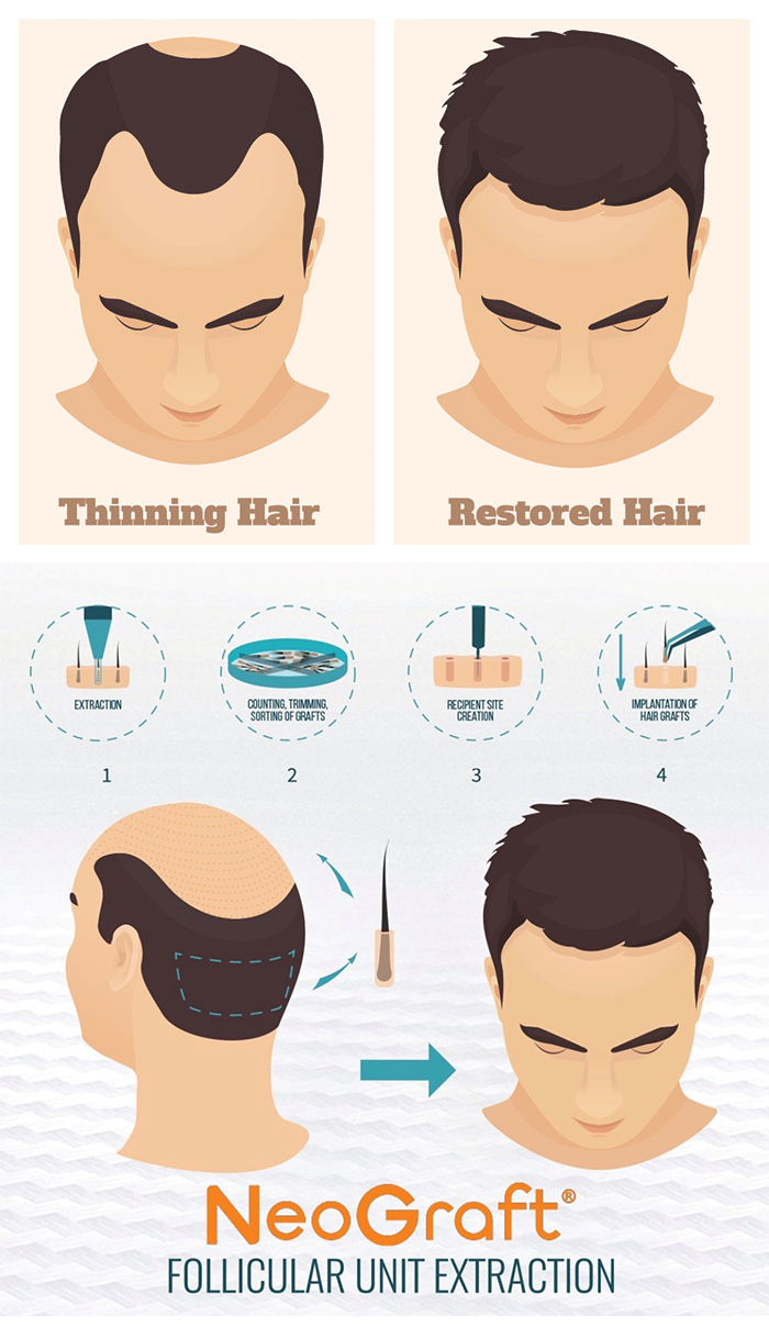 REMEDY Hair Restoration & Medical Spa Photo