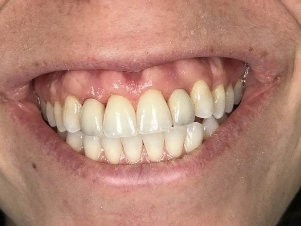 Images Nicole E. Kuske, DDS