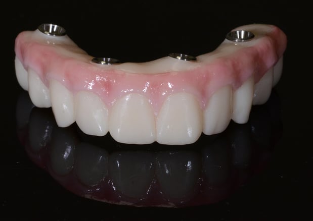 Images Nashville Wisdom Teeth and Implant Solutions