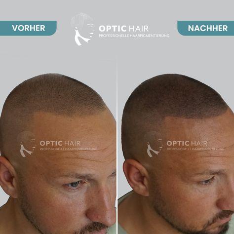 Haarpigmentierung Köln | OpticHair, Höninger Weg 176 in Köln