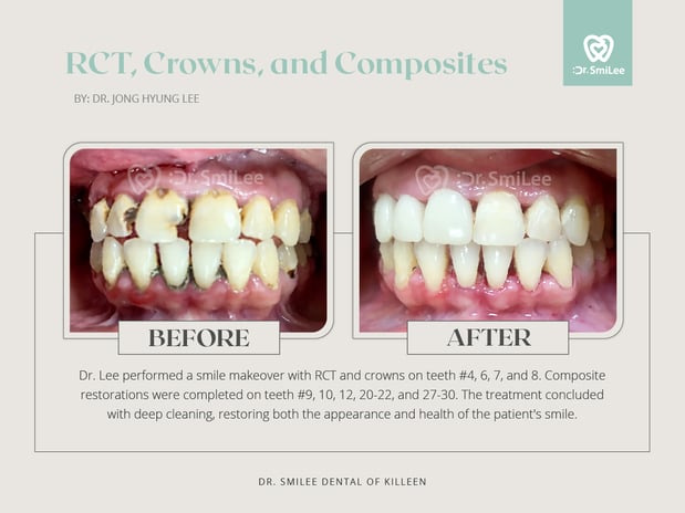Images Dr Smilee Dental of Killeen, Family, Cosmetic, Implant, Medspa