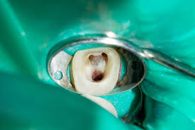Images Studio Dentistico  Semeraro Dr. Stefano