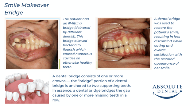 Images Absolute Dental