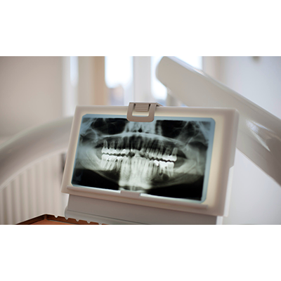 MKG-Praxis in der Lichtburg, Bahnhofstraße 15A in Herne