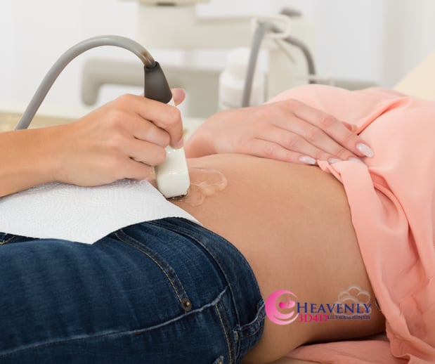 Images Heavenly 3D 4D Ultrasounds