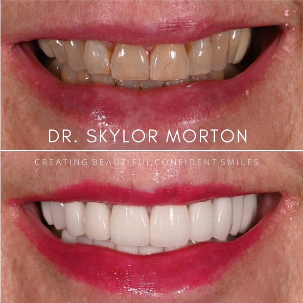 Images Nashville Wisdom Teeth and Implant Solutions