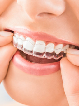 Images Inspire Dental of Roswell