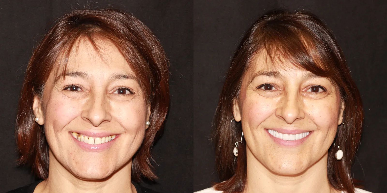 Intermountain Smiles Image