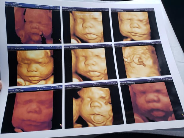 Images Heavenly 3D 4D Ultrasounds-Apple Valley