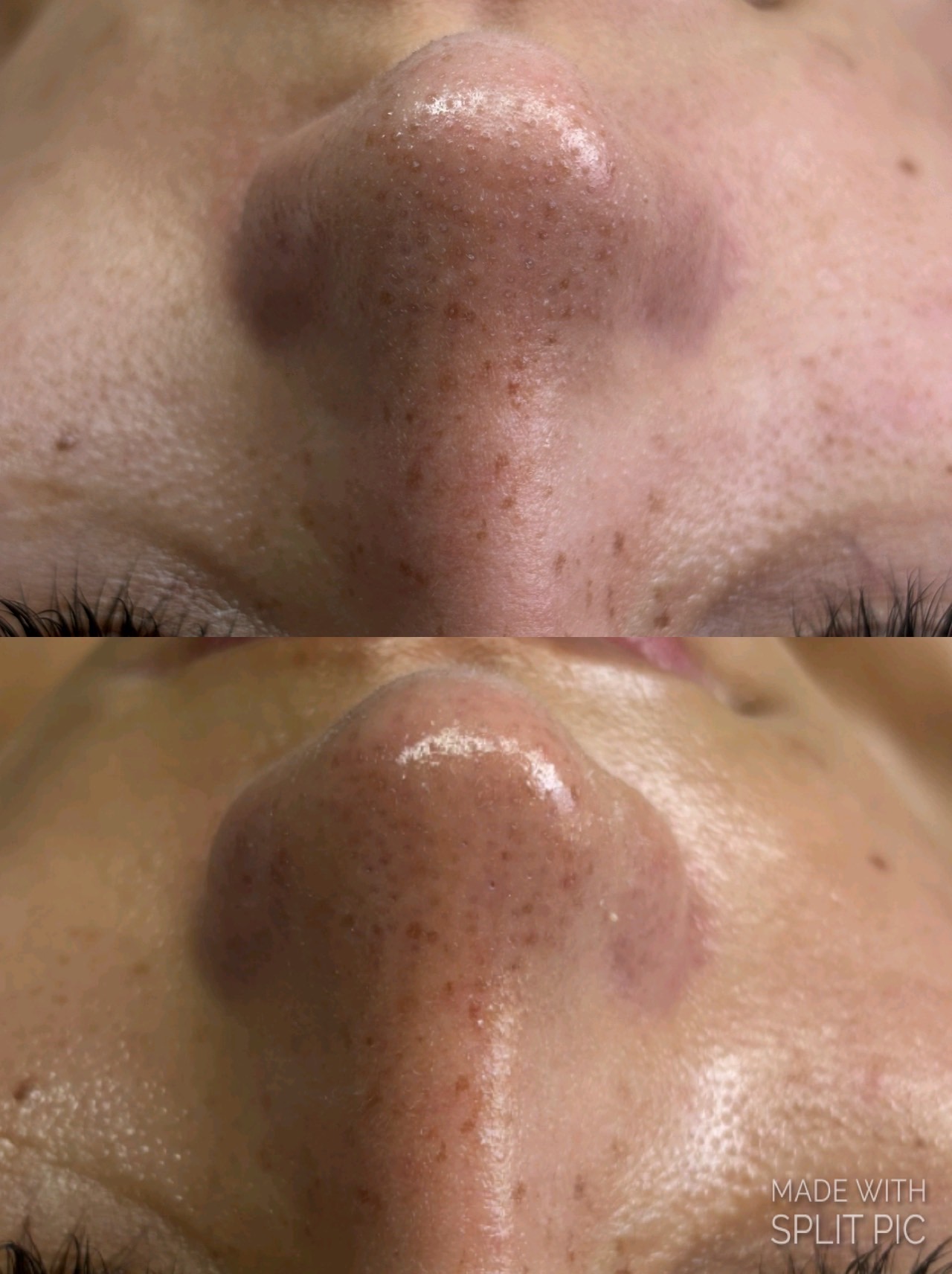 This is a before and after photo of our extraction process. Helping you look your best!