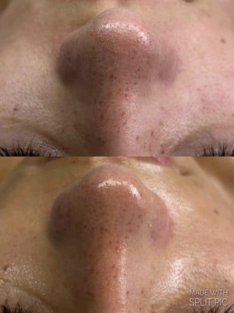 Images Radiate Studio | Esthetics & Event Makeup + Hair