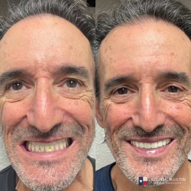 Images South Austin Dental Associates