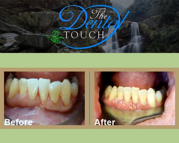 Images The Dental Touch Oakland