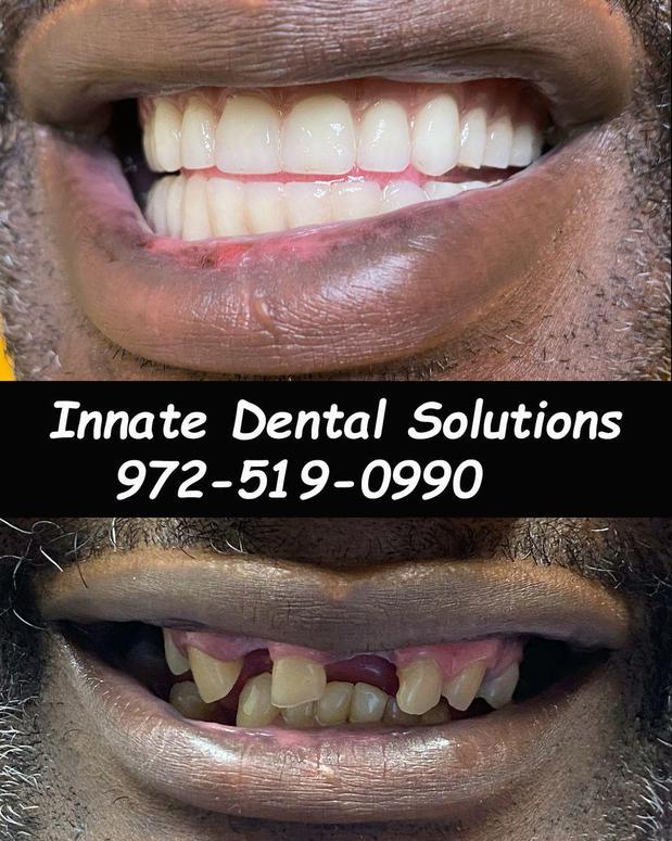 Images Innate Dental Solutions