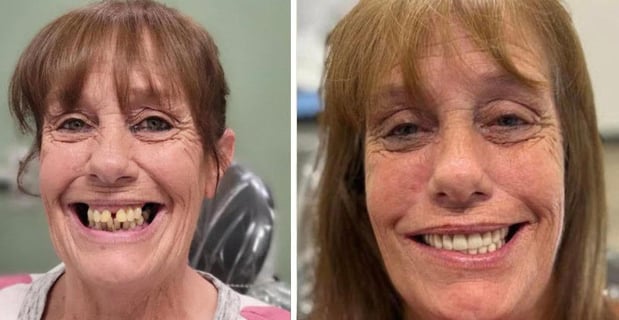 Images Redeemed Smiles - Dentures Implants & Dentistry Yukon