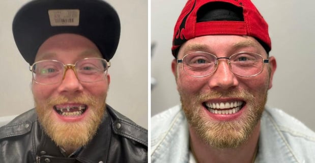 Images Redeemed Smiles - Dentures Implants & Dentistry Yukon