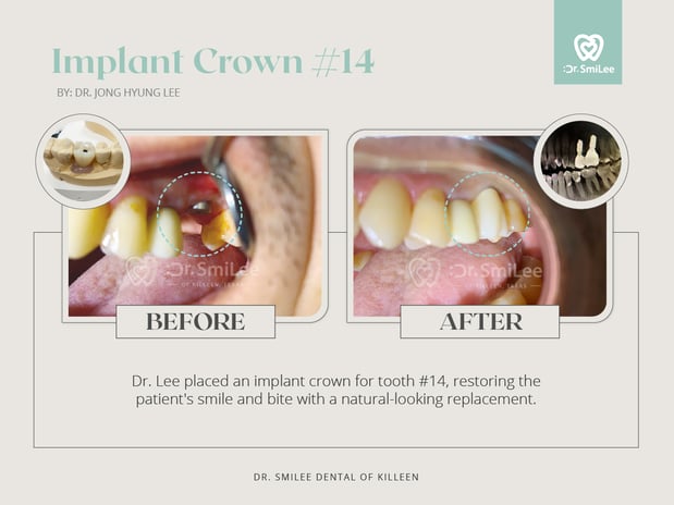 Images Dr Smilee Dental of Killeen, Family, Cosmetic, Implant, Medspa