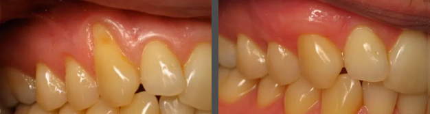 Images Embarcadero Dentistry