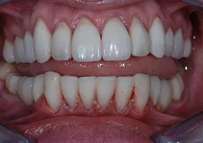 Images Smile Dental Laboratory