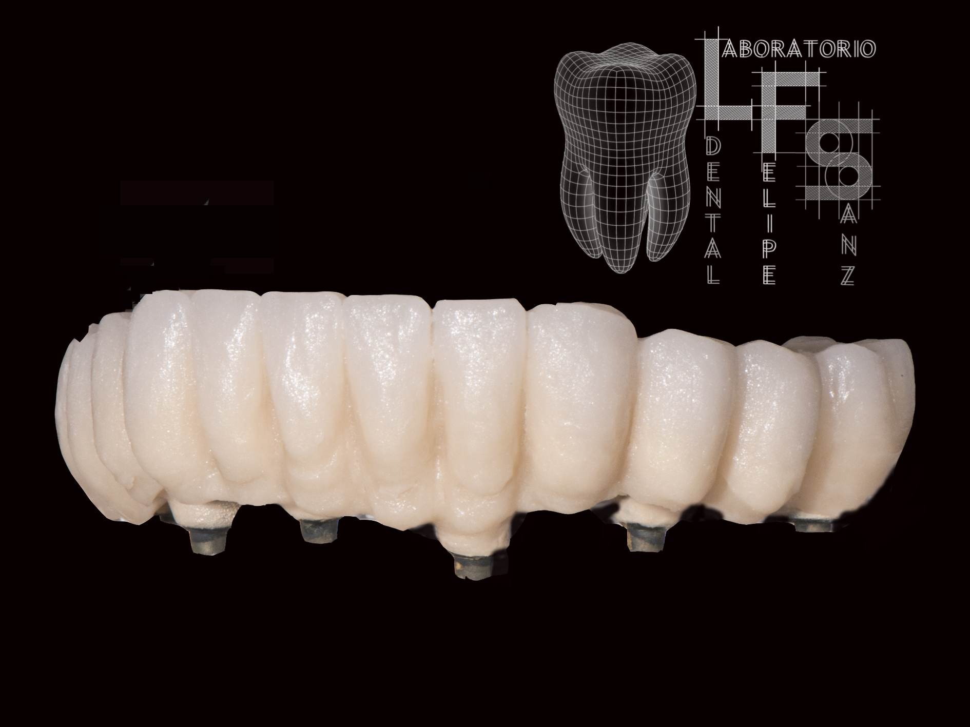 Images Laboratorio Dental Felipe Sanz