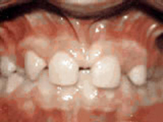 Images Marsh Orthodontics - William F Marsh DDS