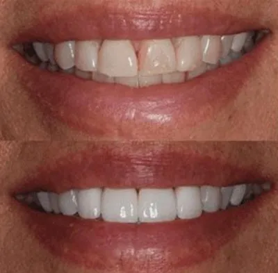 Images D'Angelo/Hoffman/Olson La Jolla Dentistry