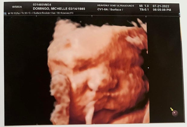 Images Heavenly 3D 4D Ultrasounds
