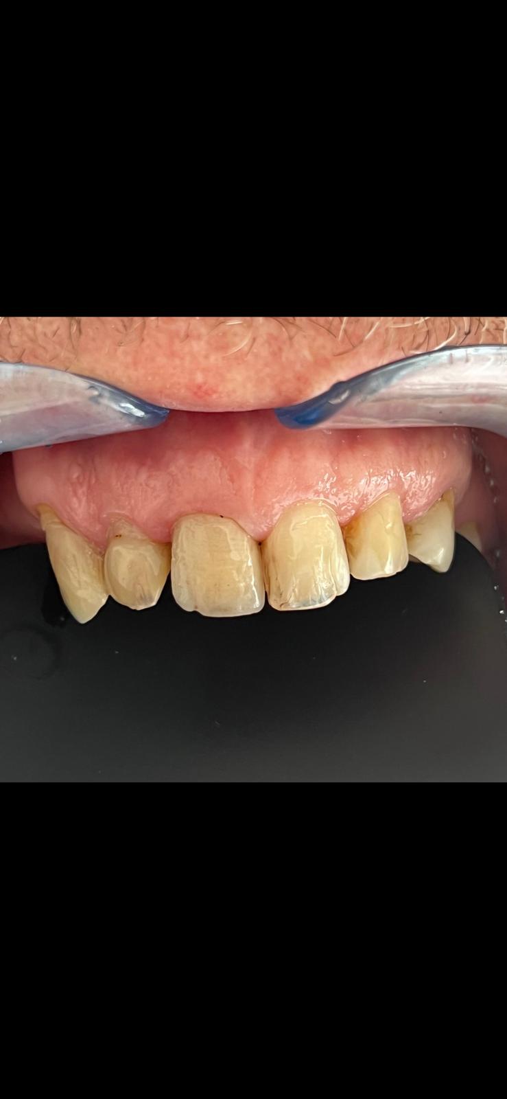 Bilder DentalLook Sagl