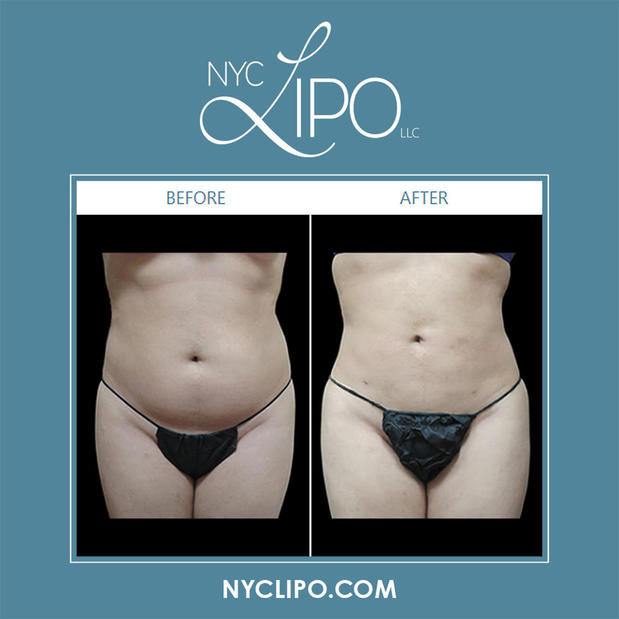 Images NYC Lipo LLC
