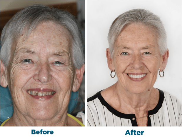 Images Smiles for Life Dental Care - Bridgewater