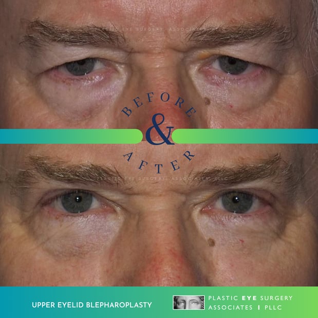 Images Plastic Eye Surgery Associates, PLLC