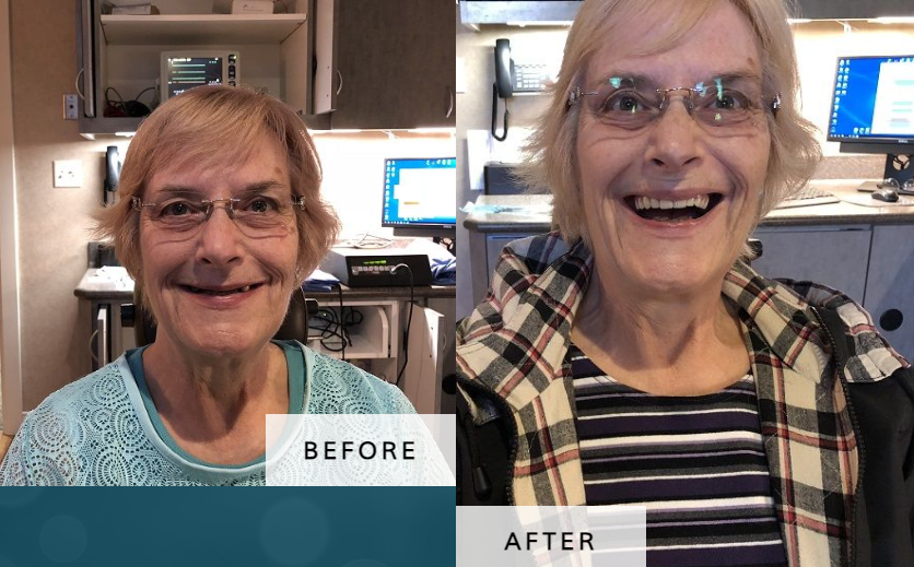 Before & After of Andrew R. Glenn, DDS, MD | Lincoln, NE