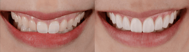 Images Jeppson Dental