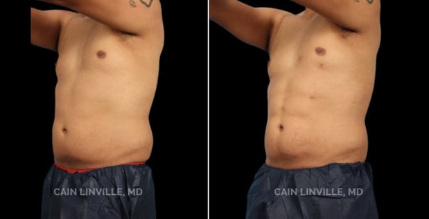 Images Linville Plastic Surgery