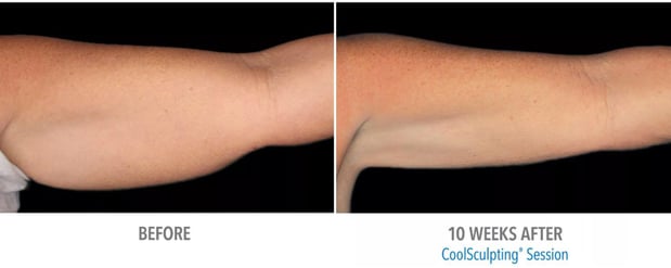 Images Renew Body Contouring & MedSpa